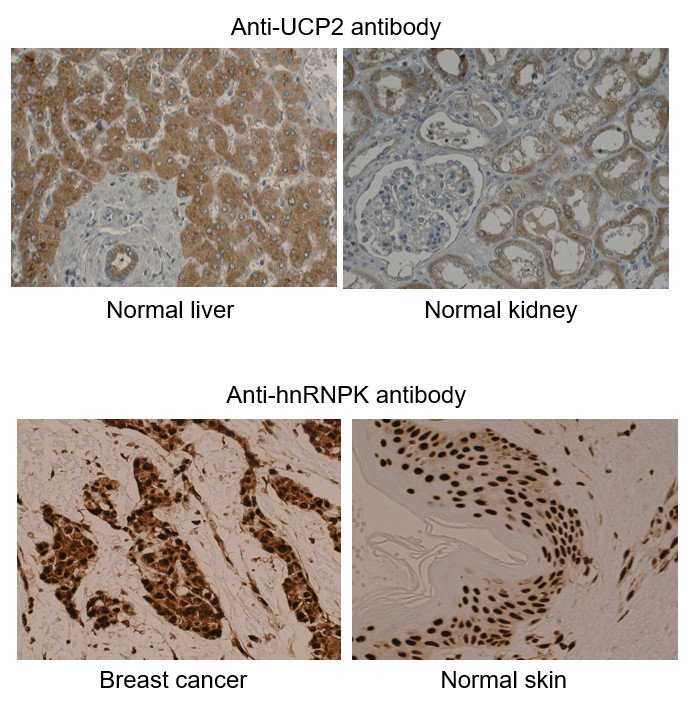 More IHC Examples More IHC Examples