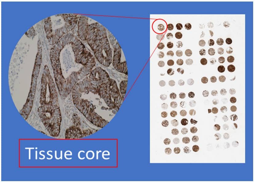 tissue core tissue core